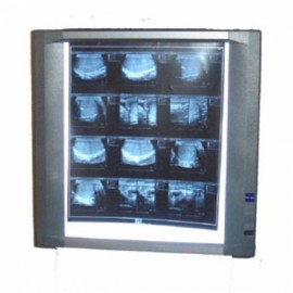 Negatoscopio sencillo de LED Mod. NGPII-1 con 8 niveles de intensidad-PuntoMedico- MLG-NGPII-1