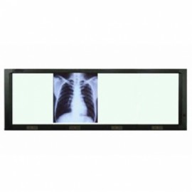 Negatoscopio cuadruple de pared con luz LED-PuntoMedico- BAM-320L
