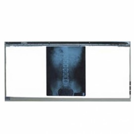 Negatoscopio de tres pantallas Mod. Avante (lámparas rectas)-PuntoMedico- CIS-6320